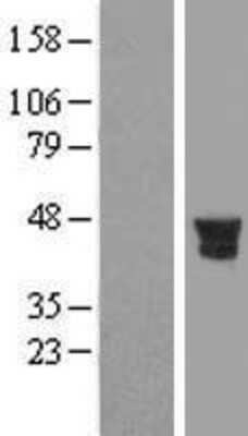 Western Blot: PTPN7 Overexpression Lysate (Adult Normal) [NBL1-14978] Left-Empty vector transfected control cell lysate (HEK293 cell lysate); Right -Over-expression Lysate for PTPN7.