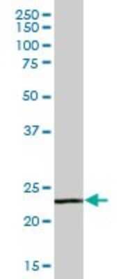 Western Blot: PTPNS1L2 Antibody [H00128646-B01P] - Analysis of PTPNS1L2 expression in human spleen.