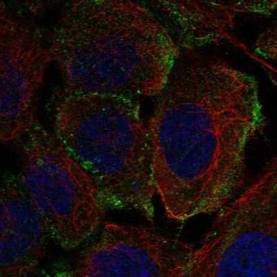 Immunocytochemistry/Immunofluorescence: PTPRB Antibody [NBP2-56421] - Staining of human cell line A-431 shows localization to plasma membrane & vesicles. Antibody staining is shown in green.