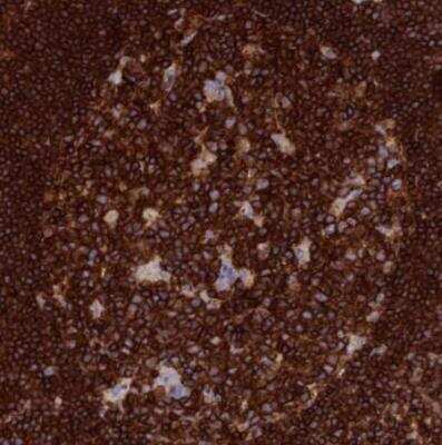 Immunohistochemistry-Paraffin PTPRCAP Antibody - BSA Free