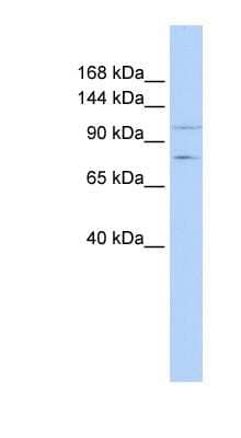 Western Blot: PTPRH Antibody [NBP1-62256] - MCF-7 whole cell lysates, concentration 0.2-1 ug/ml.