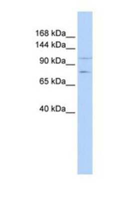 Western Blot: PTPRH Antibody [NBP1-69289] - This Anti-PTPRH antibody was used in Western Blot of MCF7 tissue lysate at a concentration of 1ug/ml.