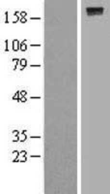 Western Blot: PTPRJ Overexpression Lysate (Adult Normal) [NBL1-14985] Left-Empty vector transfected control cell lysate (HEK293 cell lysate); Right -Over-expression Lysate for PTPRJ.