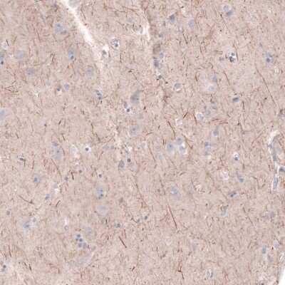 Immunohistochemistry-Paraffin: PTPRK Antibody [NBP2-30977] - Staining of human cerebral cortex shows moderate positivity in a subset of neural fibers.