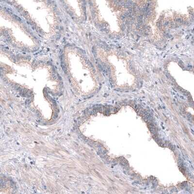 Immunohistochemistry-Paraffin: PTPRK Antibody [NBP2-30977] - Staining of human prostate shows moderate positivity in apical membranes in glandular cells.