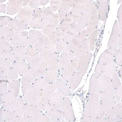 Immunohistochemistry-Paraffin: PTPRK Antibody [NBP2-30977] - Staining of human skeletal muscle shows no positivity in striated muscle fibers as expected.