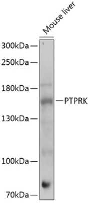 Western Blot: PTPRK Antibody [NBP2-93841] - Analysis of extracts of mouse liver, using PTPRK .Exposure time: 60s.