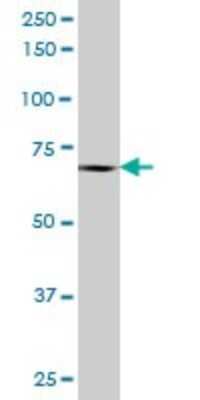 Western Blot: PTPRN2 Antibody [H00005799-B01P] - Analysis of PTPRN2 expression in human kidney.