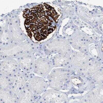 Immunohistochemistry-Paraffin: PTPRO Antibody [NBP1-81826] - Staining of human kidney shows strong membranous positivity in cells in glomeruli.