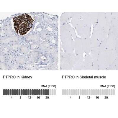 Immunohistochemistry-Paraffin: PTPRO Antibody [NBP1-81826] - Staining in human kidney and skeletal muscle tissues . Corresponding PTPRO RNA-seq data are presented for the same tissues.