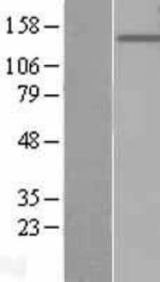 Western Blot: PTPRO Overexpression Lysate (Adult Normal) [NBL1-14986] Left-Empty vector transfected control cell lysate (HEK293 cell lysate); Right -Over-expression Lysate for PTPRO.