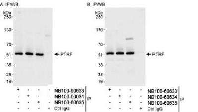 Immunoprecipitation: PTRF Antibody [NB100-60634] - Detection of Human PTRF by Western Blot of Immunoprecipitates.  Samples: Whole cell lysate (1 mg for IP, 20% of IP loaded) from HeLa cells. Antibodies: Affinity purified rabbit anti-PTRF antibody NB100-60634 used for IP at 3 mcg/mg lysate. PTRF was also immunoprecipitated by rabbit anti-PTRF antibodies NB100-60633 and NB100-60635, which recognize other epitopes. Detection: Chemiluminescence with exposure times of 3 seconds (A and B).