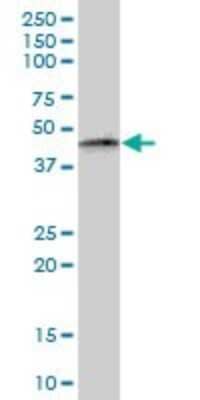 Western Blot: PTRF Antibody [H00284119-B01P] - Analysis of PTRF expression in human spleen.