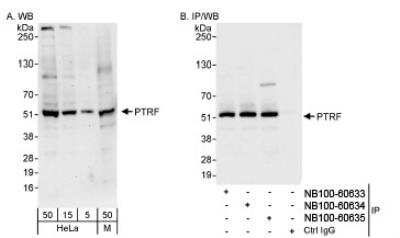 Western Blot: PTRF Antibody [NB100-60635] - Detection of Human and Mouse PTRF on HeLa whole cell lysate using NB100-60635. PTRF was also immunoprecipitated by rabbit anti-PTRF antibodies NB100-60633 and NB100-60634.