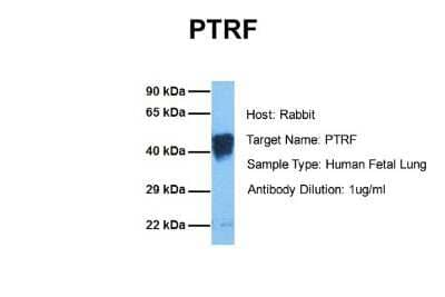 Western Blot: PTRF Antibody [NBP1-80220] - Sample Tissue: Human Fetal Lung Antibody Dilution: 1.0 ug/ml