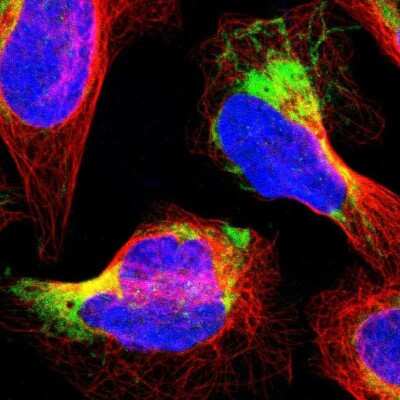 Immunocytochemistry/ Immunofluorescence PTRH2 Antibody