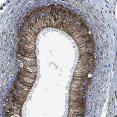 Immunohistochemistry-Paraffin PTRH2 Antibody