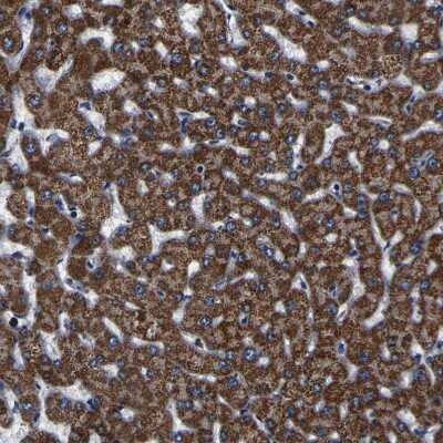 Immunohistochemistry-Paraffin PTRH2 Antibody