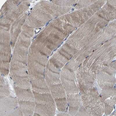 Immunohistochemistry-Paraffin: PTRH2 Antibody [NBP1-88595] - Staining of human skeletal muscle shows moderate cytoplasmic positivity in myocytes.