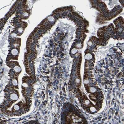 Immunohistochemistry-Paraffin: PTRH2 Antibody [NBP1-88595] - Staining of human small intestine shows strong granular cytoplasmic positivity in glandular cells.