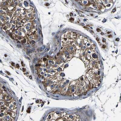 Immunohistochemistry-Paraffin: PTRH2 Antibody [NBP1-88595] - Staining of human testis shows strong granular cytoplasmic positivity in cells in seminiferous ducts.