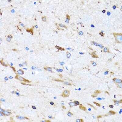 Immunohistochemistry-Paraffin: PTRH2 Antibody [NBP2-94026] - Paraffin-embedded mouse spinal cord using PTRH2 .