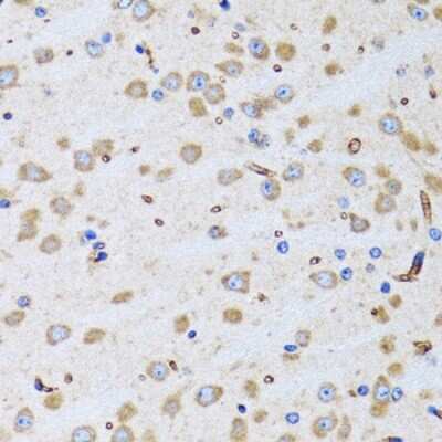 Immunohistochemistry-Paraffin: PTRH2 Antibody [NBP2-94026] - Paraffin-embedded rat brain using PTRH2 .