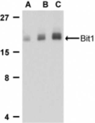 Western Blot: PTRH2 Antibody [NB100-55963] - Western blot analysis of Bit1 in Daudi cell lysate with Bit1 antibody using NB100-55963 at (A) 1, (B) 2, and (C) 4 ug/ml.