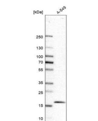 Western Blot: PTRH2 Antibody [NBP1-88595] - Analysis in human cell line A-549.