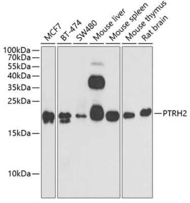 Western Blot PTRH2 Antibody - BSA Free