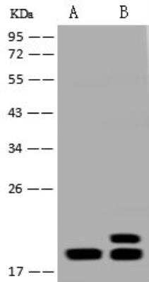 Western Blot: PTRH2 Antibody [NBP3-12579] - Lane A: Jurkat Whole Cell LysateLane B: HepG2 Whole Cell LysateLysates/proteins at 30 ug per lane.SecondaryGoat Anti-Rabbit IgG (H+L)/HRP at 1/10000 dilution.Developed using the ECL technique.Performed under reducing conditions.Predicted band size:19 kDaObserved band size:19 kDa(We are unsure as to the identity of these extra bands.)