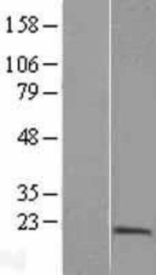 Western Blot: PTRH2 Overexpression Lysate (Adult Normal) [NBL1-14990] Left-Empty vector transfected control cell lysate (HEK293 cell lysate); Right -Over-expression Lysate for PTRH2.