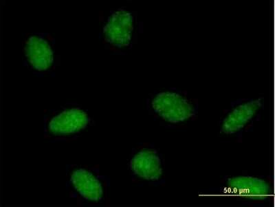 Immunocytochemistry/Immunofluorescence: PTS Antibody [H00005805-B01P] - Analysis of purified antibody to PTS on HeLa cell. (antibody concentration 10 ug/ml)