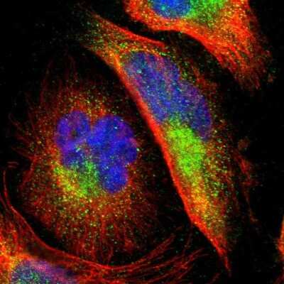 Immunocytochemistry/Immunofluorescence: PTS Antibody [NBP1-87187] - Staining of human cell line U-251 MG shows localization to cytosol. Antibody staining is shown in green.