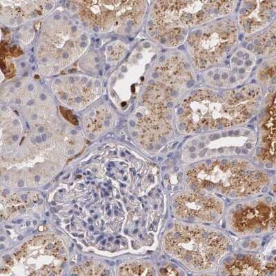 Immunohistochemistry-Paraffin: PTS Antibody [NBP1-87187] - Staining of human kidney shows cytoplasmic and membranous positivity in cells of renal tubules.