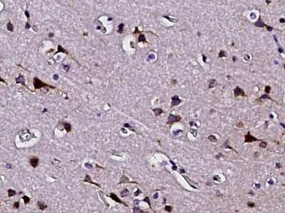 Immunohistochemistry-Paraffin: PTS Antibody [NBP3-00276] - Immunochemical staining of human PTS in human brain with rabbit polyclonal antibody (1:2000, formalin-fixed paraffin embedded sections).