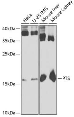 Western Blot: PTS Antibody [NBP2-93782] - Analysis of extracts of various cell lines, using PTS at 1:1000 dilution. Secondary antibody: HRP Goat Anti-Rabbit IgG (H+L) at 1:10000 dilution. Lysates/proteins: 25ug per lane. Blocking buffer: 3% nonfat dry milk in TBST. Detection: ECL Basic Kit . Exposure time: 30s.