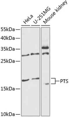 Western Blot: PTS Antibody [NBP2-94788] - Analysis of extracts of various cell lines, using PTS at 1:1000 dilution. Secondary antibody: HRP Goat Anti-Rabbit IgG (H+L) at 1:10000 dilution. Lysates/proteins: 25ug per lane. Blocking buffer: 3% nonfat dry milk in TBST. Detection: ECL Basic Kit . Exposure time: 60s.