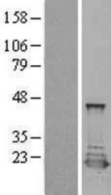 Western Blot: PTS Overexpression Lysate (Adult Normal) [NBL1-14991] Left-Empty vector transfected control cell lysate (HEK293 cell lysate); Right -Over-expression Lysate for PTS.