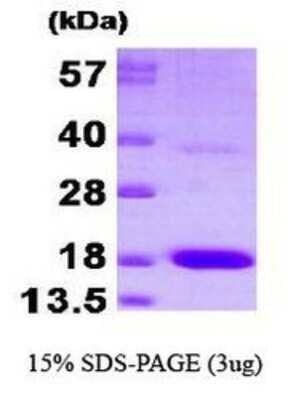 SDS-Page: PTS Protein [NBP1-37071] - PTS, 18.5 kDa (165aa), confirmed by MALDI-TOF with a purity of 90% by SDS - PAGE