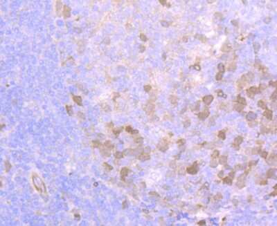 Immunohistochemistry-Paraffin: PTTG1 Antibody (JB37-37) [NBP2-75659] - Analysis of paraffin-embedded human tonsil tissue using anti-Securin antibody. Counter stained with hematoxylin.