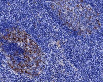 Immunohistochemistry-Paraffin: PTTG1 Antibody (JB37-37) [NBP2-75659] - Analysis of paraffin-embedded human tonsil tissue with Rabbit anti-PTTG1 antibody. The section was pre-treated using heat mediated antigen retrieval with sodium citrate buffer (pH 6.0) for 2 minutes. The tissues were blocked in 1% BSA for 20 minutes at room temperature, washed with ddH2O and PBS, and then probed with the primary antibody for 1 hour at room temperature. The detection was performed using an HRP conjugated compact polymer system. DAB was used as the chromogen. Tissues were counterstained with hematoxylin and mounted with DPX.