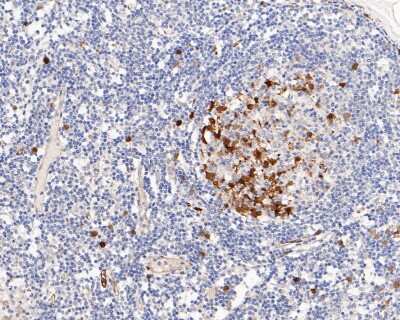 Immunohistochemistry-Paraffin: PTTG1 Antibody (JB37-37) [NBP2-75659] - Analysis of paraffin-embedded human lymph nodes tissue with Rabbit anti-Securin antibody. The section was pre-treated using heat mediated antigen retrieval with sodium citrate buffer (pH 6.0) for 2 minutes. The tissues were blocked in 1% BSA for 20 minutes at room temperature, washed with ddH2O and PBS, and then probed with the primary antibody for 1 hour at room temperature. The detection was performed using an HRP conjugated compact polymer system. DAB was used as the chromogen. Tissues were counterstained with hematoxylin and mounted with DPX.