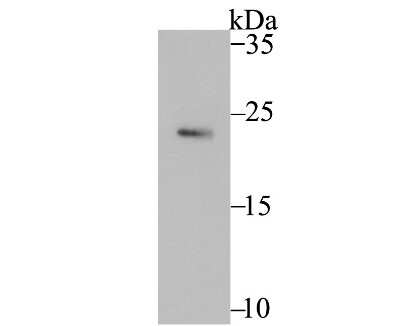 Western Blot: PTTG1 Antibody (JB37-37) [NBP2-75659] - Analysis of Securin on SiHa cell lysate using anti-Securin antibody at 1/500 dilution.