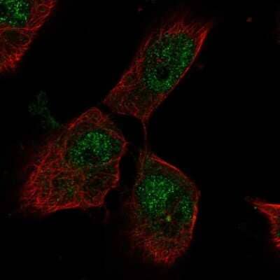 Immunocytochemistry/Immunofluorescence: PTTG1IP Antibody [NBP2-57370] - Staining of human cell line U-251 MG shows localization to nucleoplasm.