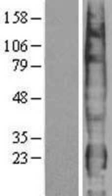 Western Blot: PTTG1IP Overexpression Lysate (Adult Normal) [NBP2-04271] Left-Empty vector transfected control cell lysate (HEK293 cell lysate); Right -Over-expression Lysate for PTTG1IP.