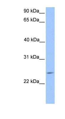 Western Blot: PTTG2 Antibody [NBP1-79377] - HepG2 cell lysate, concentration 0.2-1 ug/ml.