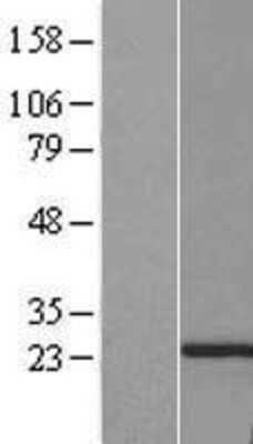 Western Blot: PTTG2 Overexpression Lysate (Adult Normal) [NBP2-07603] Left-Empty vector transfected control cell lysate (HEK293 cell lysate); Right -Over-expression Lysate for PTTG2.