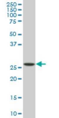 Western Blot: PU.1/Spi-1 Antibody (2G1) [H00006688-M02] - SPI1 monoclonal antibody (M02), clone 2G1. Analysis of SPI1 expression in Raw 264.7.