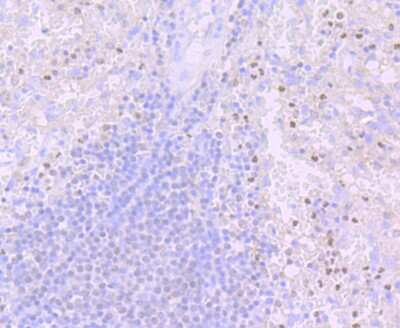 Immunohistochemistry-Paraffin: PU.1/Spi-1 Antibody (JB72-35) [NBP2-75637] - Analysis of paraffin-embedded human spleen tissue using anti-PU.1/Spi1 antibody. Counter stained with hematoxylin.
